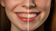 © Andy Dean - Young Adult Girl Showing Her Beautiful Before and After Teeth Whitening Smile - Generative AI.