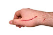 © Андрей Журавлев - A scratch with blood running down the man arm from a cat, isolated on a white background