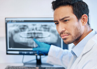 Sticker - Youve been found out. a young dentist pointing to an xray of a patients teeth.