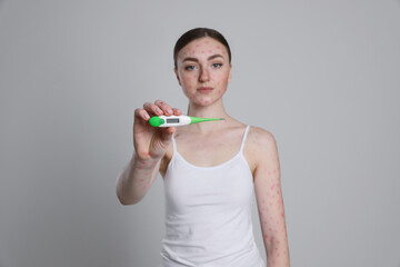 Poster - Woman with rash holding thermometer on light grey background. Monkeypox virus