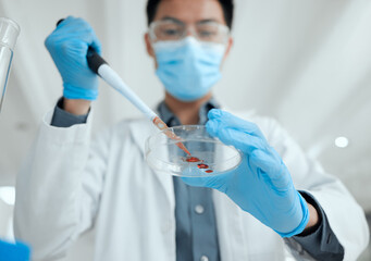 Poster - We need your donations. a young male scientist inserting a sample into a petri dish.
