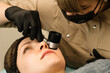 © Vagengeim - Dermatologist examines moles with dermatoscope