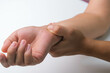 © Pornpimon - Woman with wrist pain, numbness or carpal tunnel syndrome, arthritis, neurological disease. Close-up of woman's hand holding a painful joint.