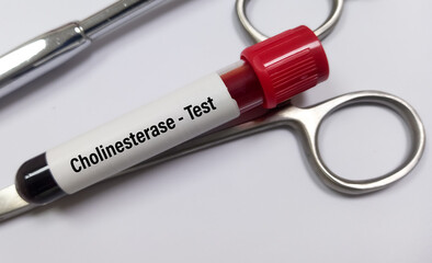 Sticker - Blood sample isolated for Cholinesterase test to determine the levels of acetylcholinesterase and pseudocholinesterase in the blood. Close view.