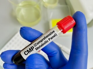 Sticker - Blood sample tube for analysis of CMP or Comprehensive Metabolic Panel in laboratory.