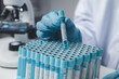 © PHOTO4U - Lab assistant, medical scientist, chemistry researcher holds a glass tube through a chemical test tube, does a chemical experiment and examines a patient's sample. Medicine and research concept.