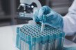 © PHOTO4U - Lab assistant, medical scientist, chemistry researcher holds a glass tube through a chemical test tube, does a chemical experiment and examines a patient's sample. Medicine and research concept.