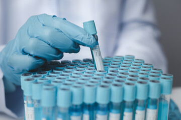 Lab assistant, medical scientist, chemistry researcher holds a glass tube through a chemical test tube, does a chemical experiment and examines a patient's sample. Medicine and research concept.