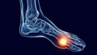 3D Rendered Medical Illustration of foot pain.
