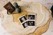 Pregnancy, ultrasound photo on the background of an epoxy resin table