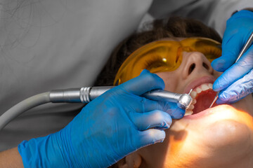 Female dentist and assistant removing dental calculus from teeth. Visit is in proffessional dental clinic. Woman sits on dental chair. Drilling and treatment of tooth, filling.
