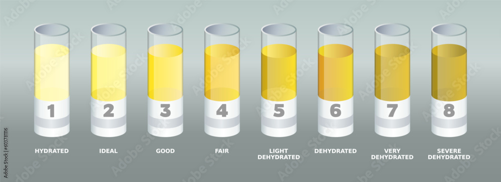 Urine color chart. Lab tubes with different urine colors samples ...