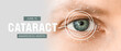 canvas print picture - Eye of young man, closeup. Banner for Cataract Awareness Month