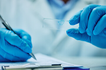 Wall Mural - close up of scientist examining sample on microscope slide and taking notes in lab.