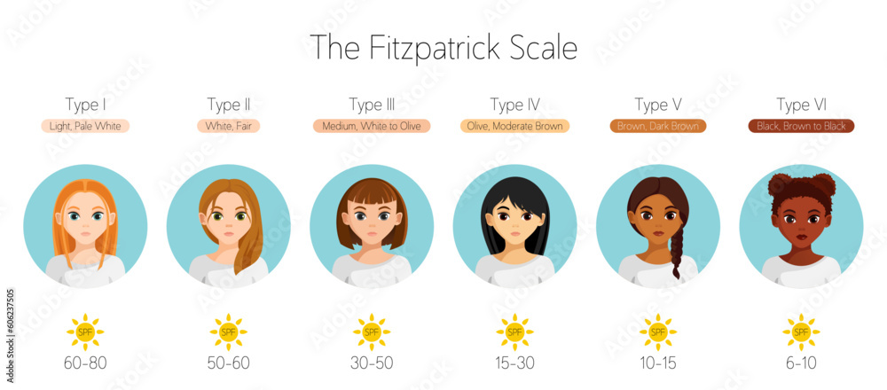 The Fitzpatrick scale. Vector cartoon infographic. Girls with different ...