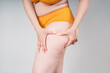 Overweight woman, fat thighs and buttocks, obesity female legs with cellulite