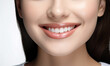 © Imagine - Smiling woman with perfect teeth, close up. Dental clinic banner. Isolated on white background female perfect tooths. Generated AI