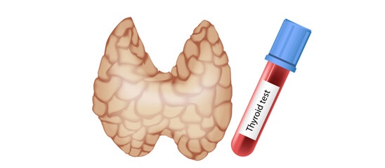 hypothyroidism vs hyperthyroidism. healthy and unhealthy thyroid test. Thyroid tumour and inflammation treatment. Parathyroid glands. neck pain and sore. Throat cancer and esophagus. Goitre problem. 