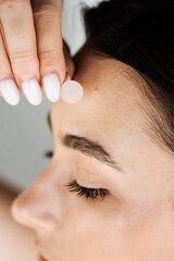 young woman using acne patches for treatment of pimple and rosacea close-up. facial rejuvenation cle
