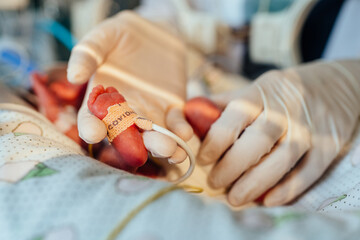 Wall Mural - Three-day-old newborn baby in intensive care unit in a medical incubator. Macro photo of doctor's hand in gloves holding legs of child. Newborn rescue concept.