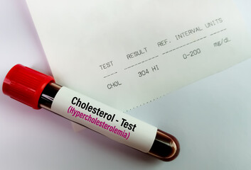 Sticker - Blood sample with abnormal high report of Cholesterol test. hypercholesterolemia