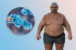 A 3D medical illustration featuring a senior overweight man with a close-up view of a cholesterol molecule