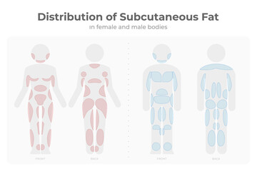 Subcutaneous fat distribution in men and women pictogram.
Vector infographic medical of fat mass areas in male and female body.
Target areas for diet treatment, liposuction, fat freezing liposculpture