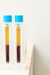 © Alvaro Lavin/Stocksy - plasma specimens extracted from the machine