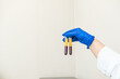 © Alvaro Lavin/Stocksy - doctor showing the plasma specimens extracted from the machine