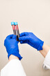 © Alvaro Lavin/Stocksy - test tubes of blood collected from the patient