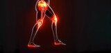 Fototapeta Konie - Arthrosis. Inflammation of the joints. Pain in the joints. Banner. generated by AI