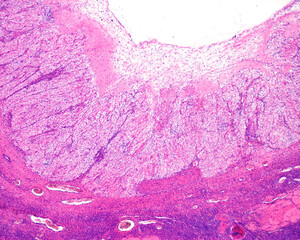 Poster - Human ovary. Regression of corpus luteum