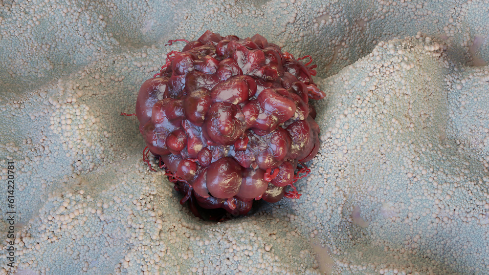 O Cancer Cancer cell growth uncontrollably over tissue, Tumor infection cells ...