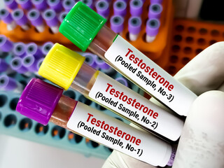 Sticker - Doctor holding Blood samples for Testosterone (Pooled sample 1, 2,3) test