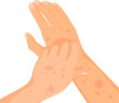 Rash skin on hand. Rashes itching hands scratch arm in red spot, dermatitis allergy symptoms itchy hives medicine pele virus eczema urticaria irritation disease vector illustration