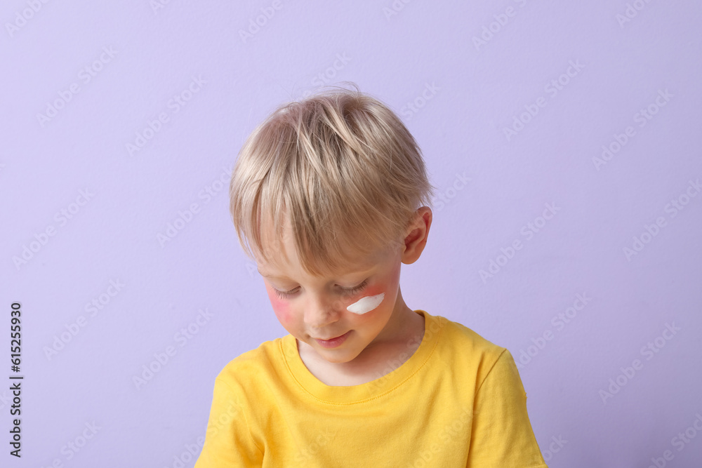 Allergic little boy with sunburned face and cream on lilac background, closeup