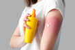 Allergic young woman with sunburned skin applying cream on grey background, closeup