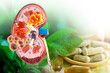 Treatment kidney disease with drug and herb background.