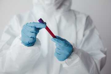 Laboratory is used for scientific research to examine and research blood obtained by sampling of patients from hospitals, lab assistants collecting blood samples from patients. Laboratory concept.