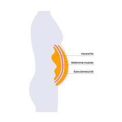 Canvas Print - Visceral fat diagram