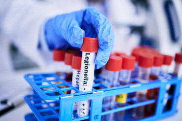 Wall Mural - Scientist, hand and bacteria sample in test tube, person in lab with medical research and healthcare study. Doctor, gloves and vaccine, check legionella sample closeup and scientific experiment