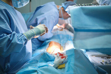 Wall Mural - Professional doctor operating a patient conducting open heart surgery in surgical room. Healthcare and medical intervention concept