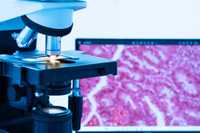 Modern Microscope And Human Tissue Section Slide With Computer Monitor Show Glandular Image.Medical Patholology And Cytology Technology Concept.Selective Focus.
