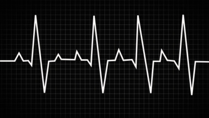 Wall Mural - ECG monitoring. Black and white glowing neon heart pulse. Heart beat. Electrocardiogram. Chest pain. ECG. EKG. Medical health care.