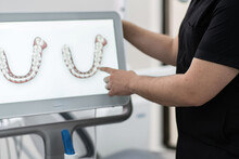 Dentist Showing Human Jaws Models On Digital Screen Conducting Presentation Of Innovative Treatment Technique Stomatology Industry Development Demonstration