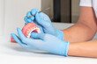 Close-up dentist hands in medical gloves hold plaster human jaw layout using plugger, describe therapy to patient. Oral hygiene orthodontic treatment