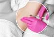 The doctor makes injections of botulinum toxin in the underarm area against hyperhidrosis. Women's cosmetology concept.