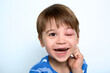 Child with swollen eye from insect bite. Face of allergic person. Allergy. Quincke edema. Portrait of laughing European appearance boy. Studio background. Isolated. Happy mood. Bruising after fight