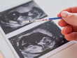 © Михаил Решетников - Woman holding a positive pregnancy test on the background of a photo with an ultrasound.