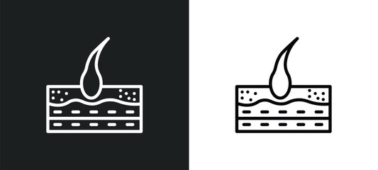 Poster - epidermis icon isolated in white and black colors. epidermis outline vector icon from medical collec
